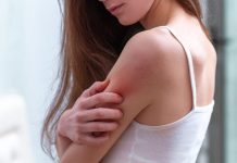 Pielea atopica, cum sa o ingrijesti pe timp de vara?